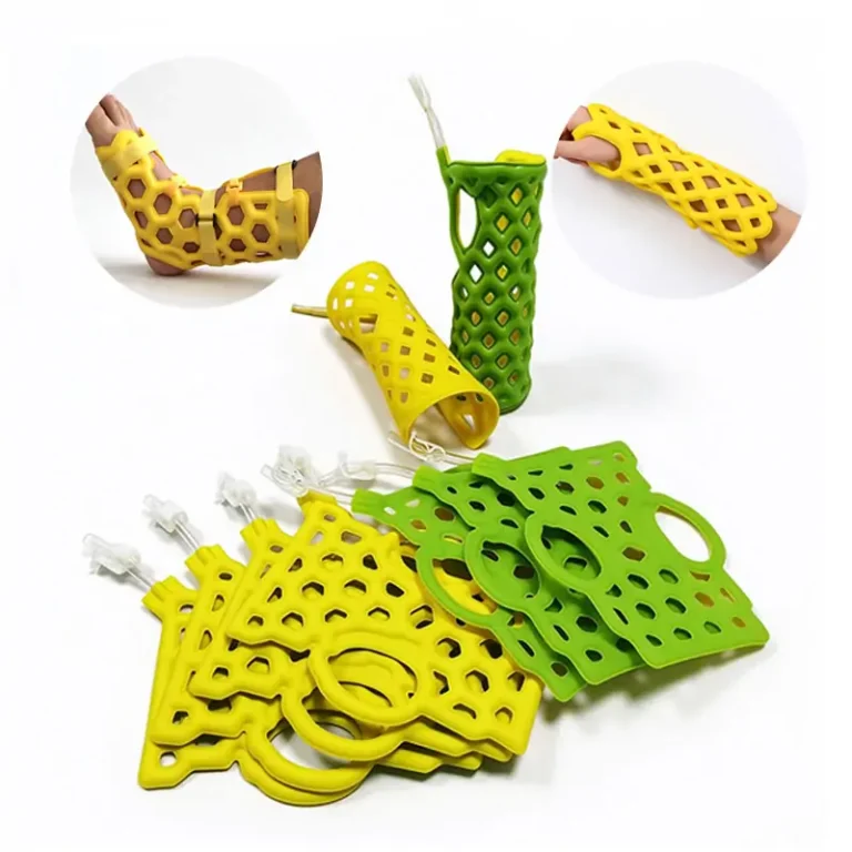 Custom Silicone Orthopedic Cast